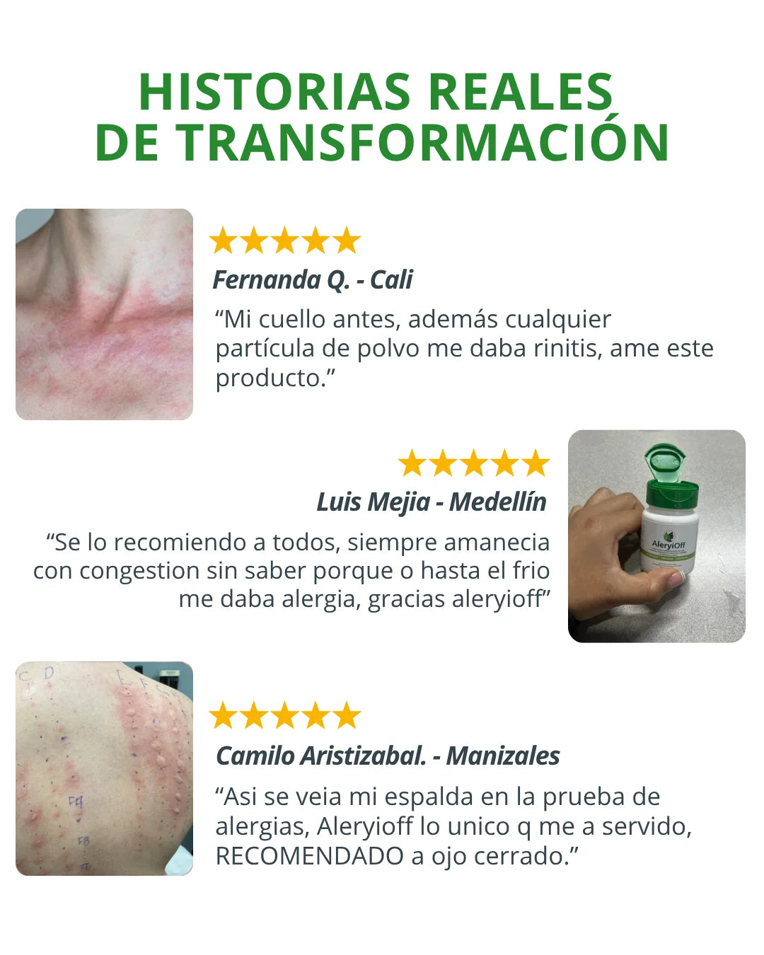 AleryiOff Tratamiento Antialérgico Natural